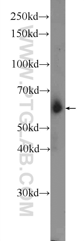 CYP1B1