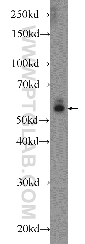 Western Blot (WB) analysis of mouse heart tissue using CYP1B1 Polyclonal antibody (18505-1-AP)