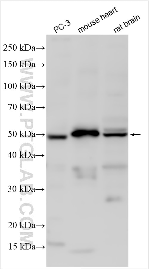 Western Blot (WB) analysis of various lysates using CYP1B1 Polyclonal antibody (18505-1-AP)