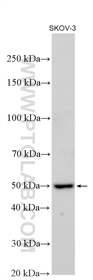 Western Blot (WB) analysis of various lysates using CYP1B1 Polyclonal antibody (18505-1-AP)