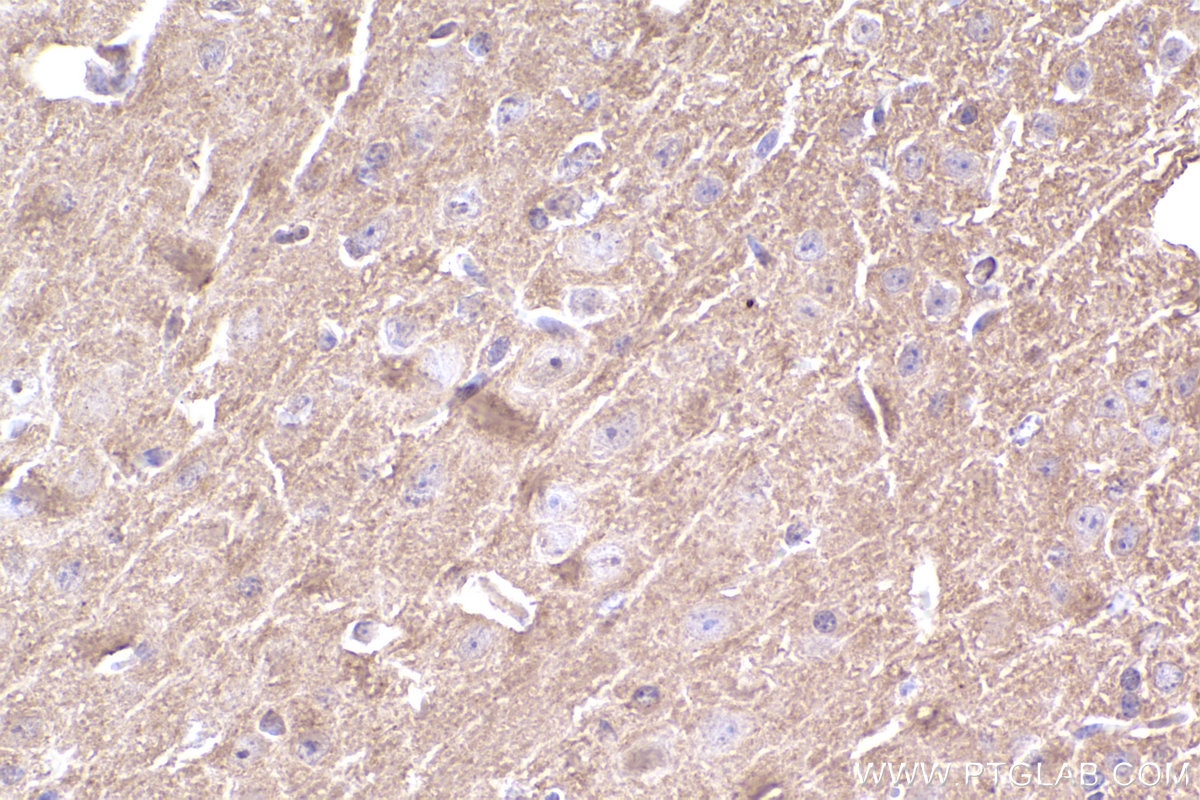Immunohistochemistry (IHC) staining of mouse brain tissue using CYP1B1 Monoclonal antibody (67033-1-Ig)
