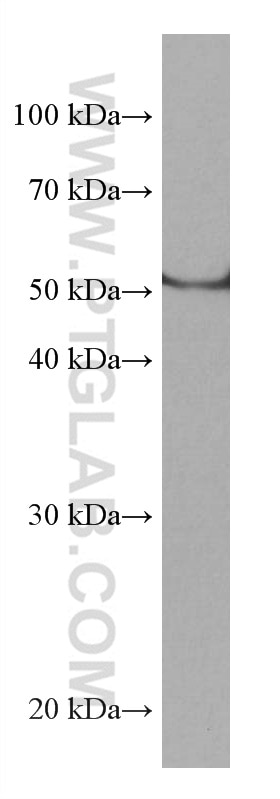 Western Blot (WB) analysis of PC-3 cells using CYP1B1 Monoclonal antibody (67033-1-Ig)