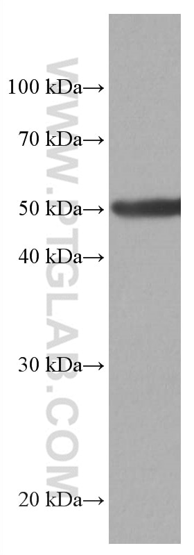 Western Blot (WB) analysis of pig brain tissue using CYP1B1 Monoclonal antibody (67033-1-Ig)