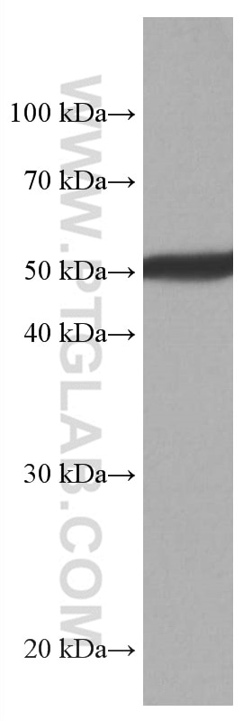 Western Blot (WB) analysis of rat brain tissue using CYP1B1 Monoclonal antibody (67033-1-Ig)