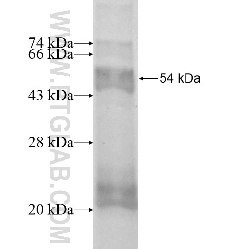 CYP1B1 fusion protein Ag13357 SDS-PAGE
