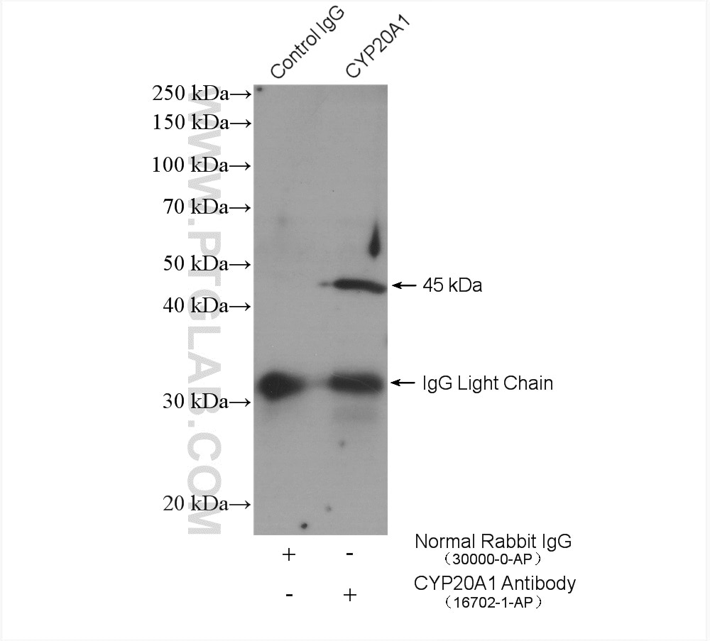 Immunoprecipitation (IP) experiment of MCF-7 cells using CYP20A1 Polyclonal antibody (16702-1-AP)