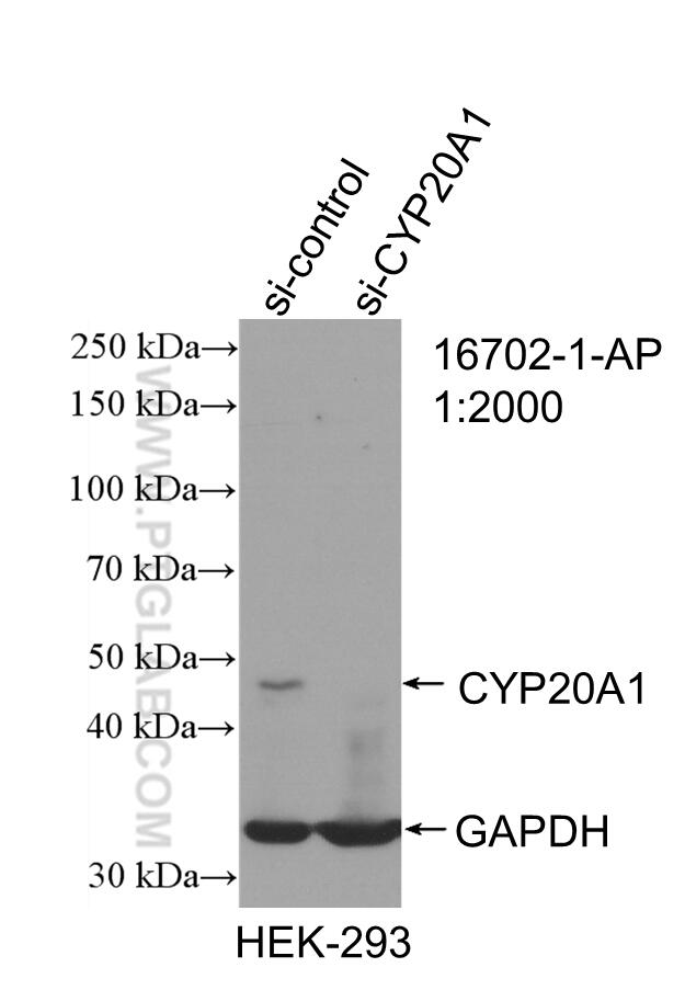 Western Blot (WB) analysis of HEK-293 cells using CYP20A1 Polyclonal antibody (16702-1-AP)