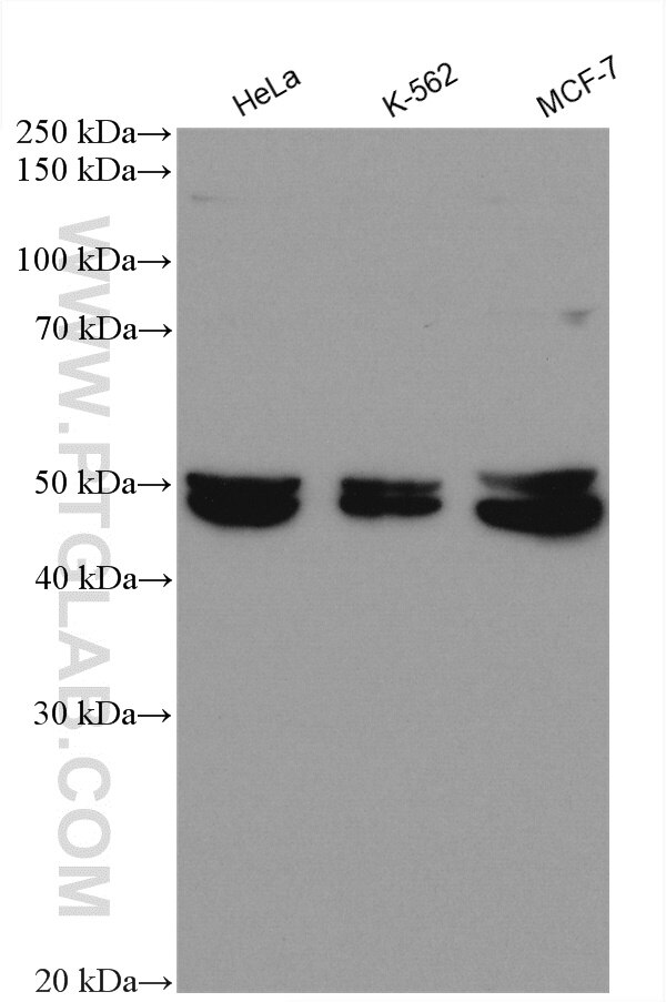Western Blot (WB) analysis of various lysates using CYP20A1 Polyclonal antibody (16702-1-AP)