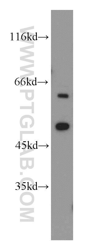 Western Blot (WB) analysis of MCF-7 cells using CYP20A1 Polyclonal antibody (16702-1-AP)