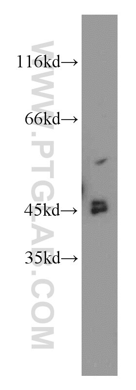 Western Blot (WB) analysis of K-562 cells using CYP20A1 Polyclonal antibody (16702-1-AP)