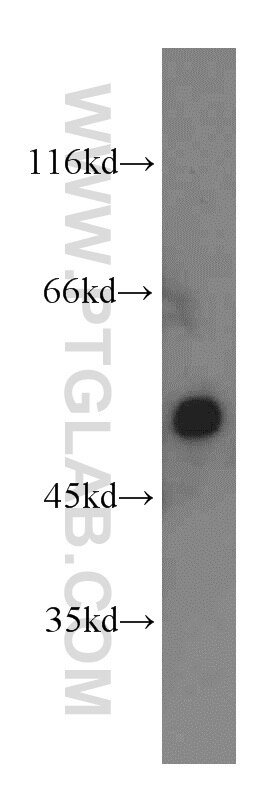 Western Blot (WB) analysis of mouse lung tissue using CYP20A1 Polyclonal antibody (16702-1-AP)