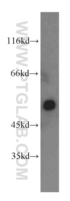 WB analysis of mouse lung using 16702-1-AP