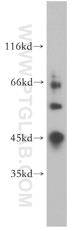 Western Blot (WB) analysis of HeLa cells using CYP20A1 Polyclonal antibody (16702-1-AP)