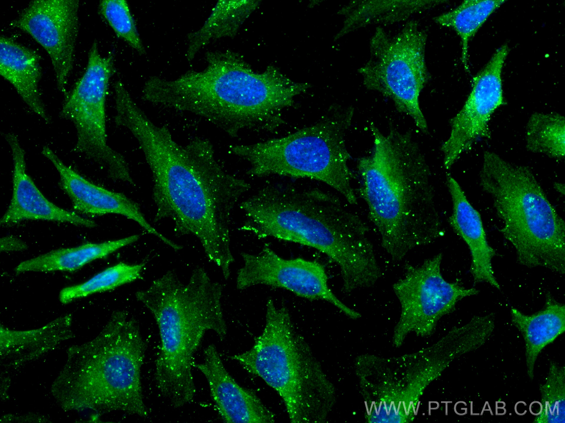 Immunofluorescence (IF) / fluorescent staining of HeLa cells using CYP20A1 Monoclonal antibody (67433-1-Ig)