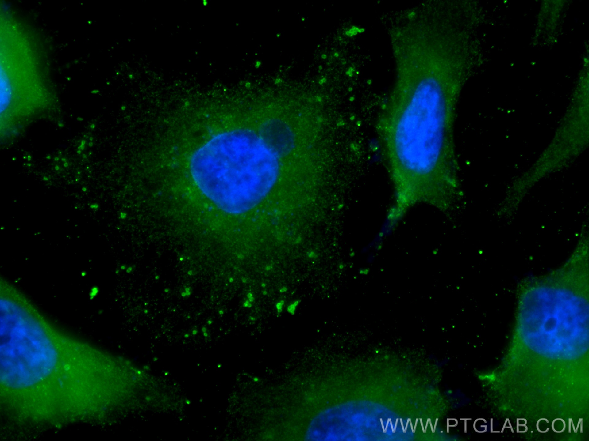 Immunofluorescence (IF) / fluorescent staining of HeLa cells using CYP20A1 Monoclonal antibody (67433-1-Ig)