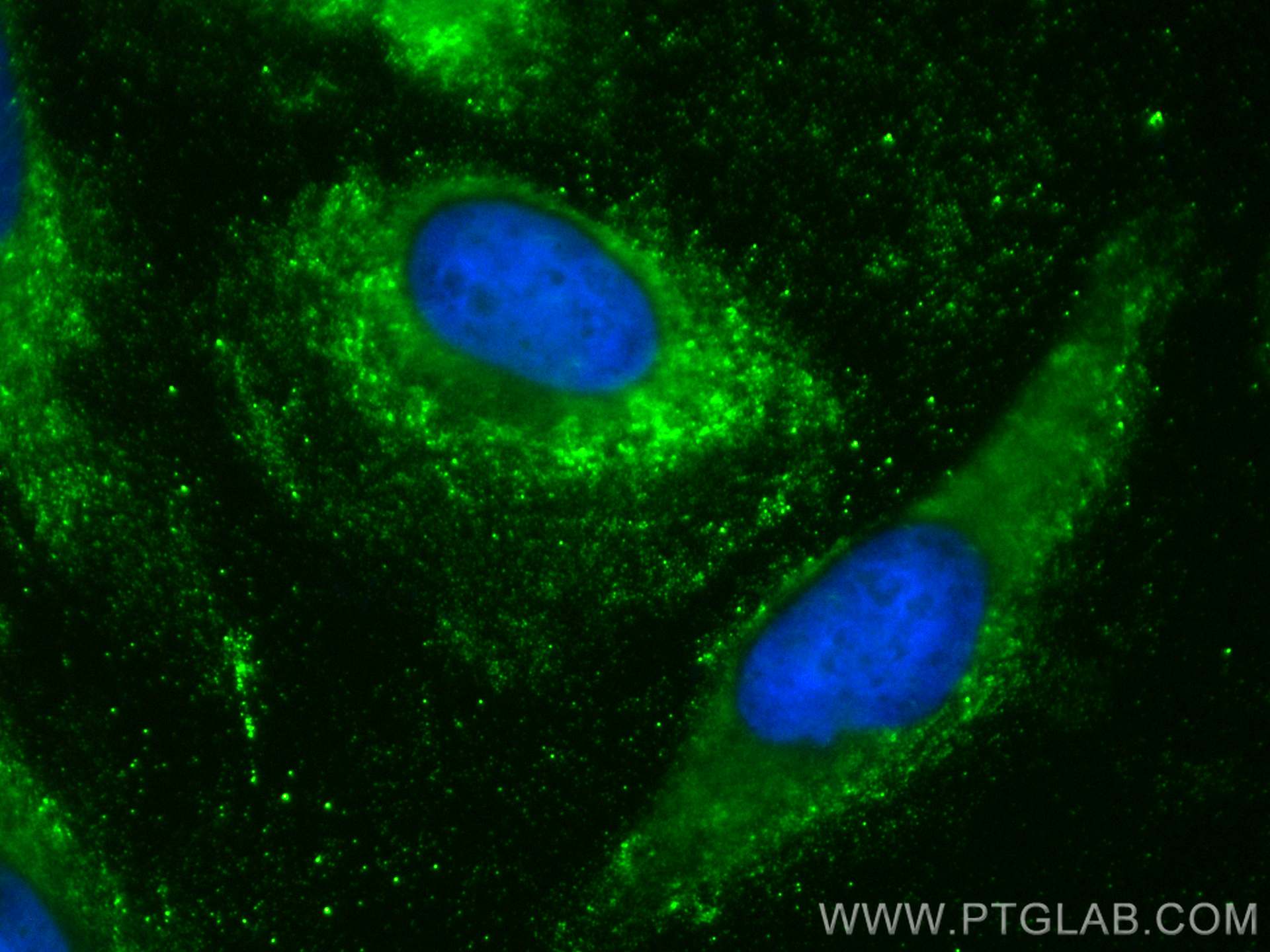 Immunofluorescence (IF) / fluorescent staining of HeLa cells using CoraLite® Plus 488-conjugated CYP20A1 Monoclonal a (CL488-67433)