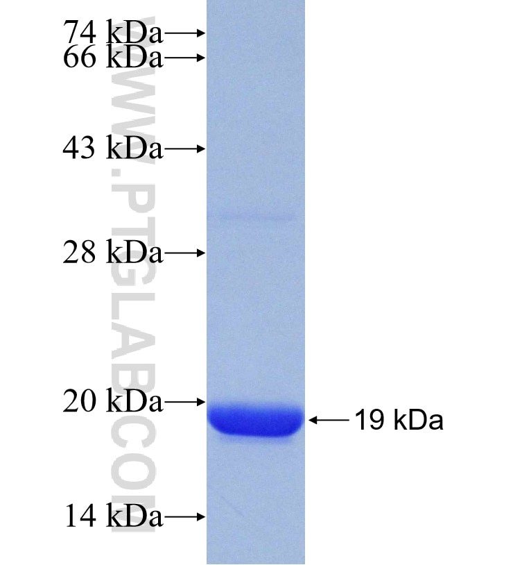CYP20A1 fusion protein Ag30066 SDS-PAGE