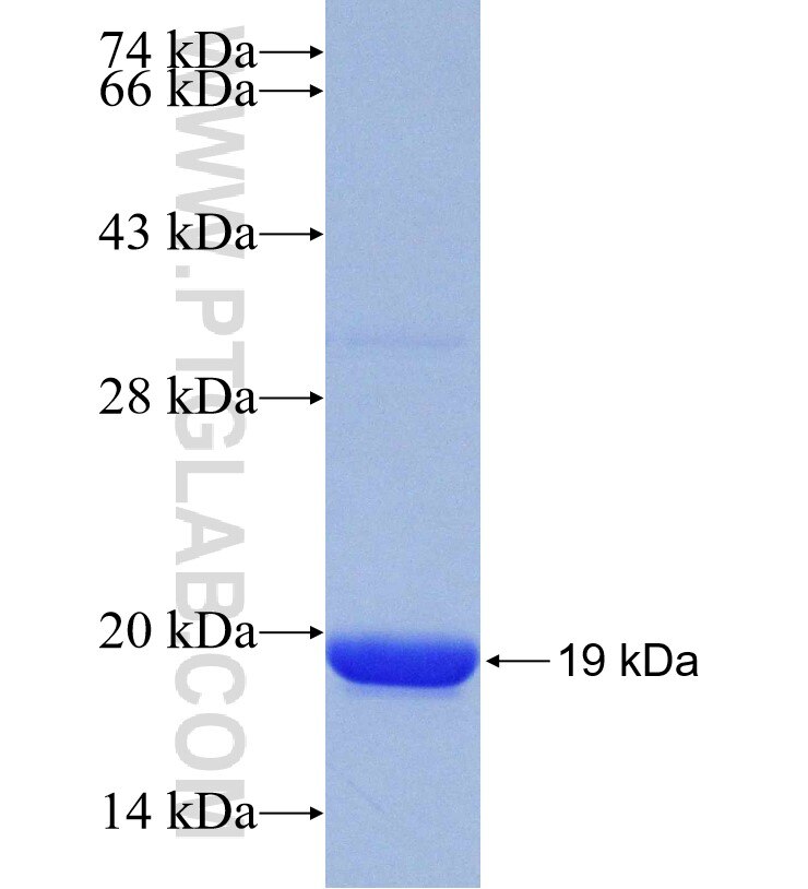 CYP20A1 fusion protein Ag30066 SDS-PAGE