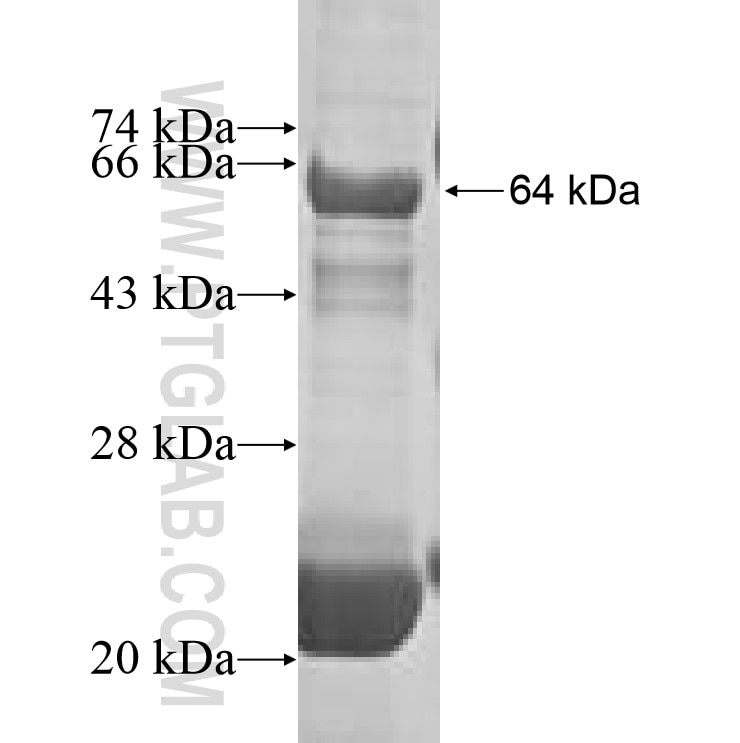 CYP20A1 fusion protein Ag10099 SDS-PAGE
