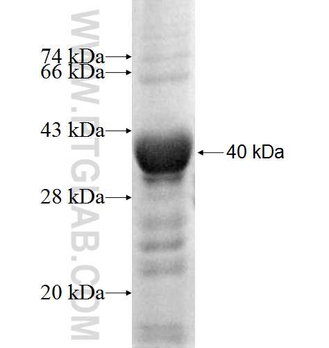 CYP20A1 fusion protein Ag9715 SDS-PAGE