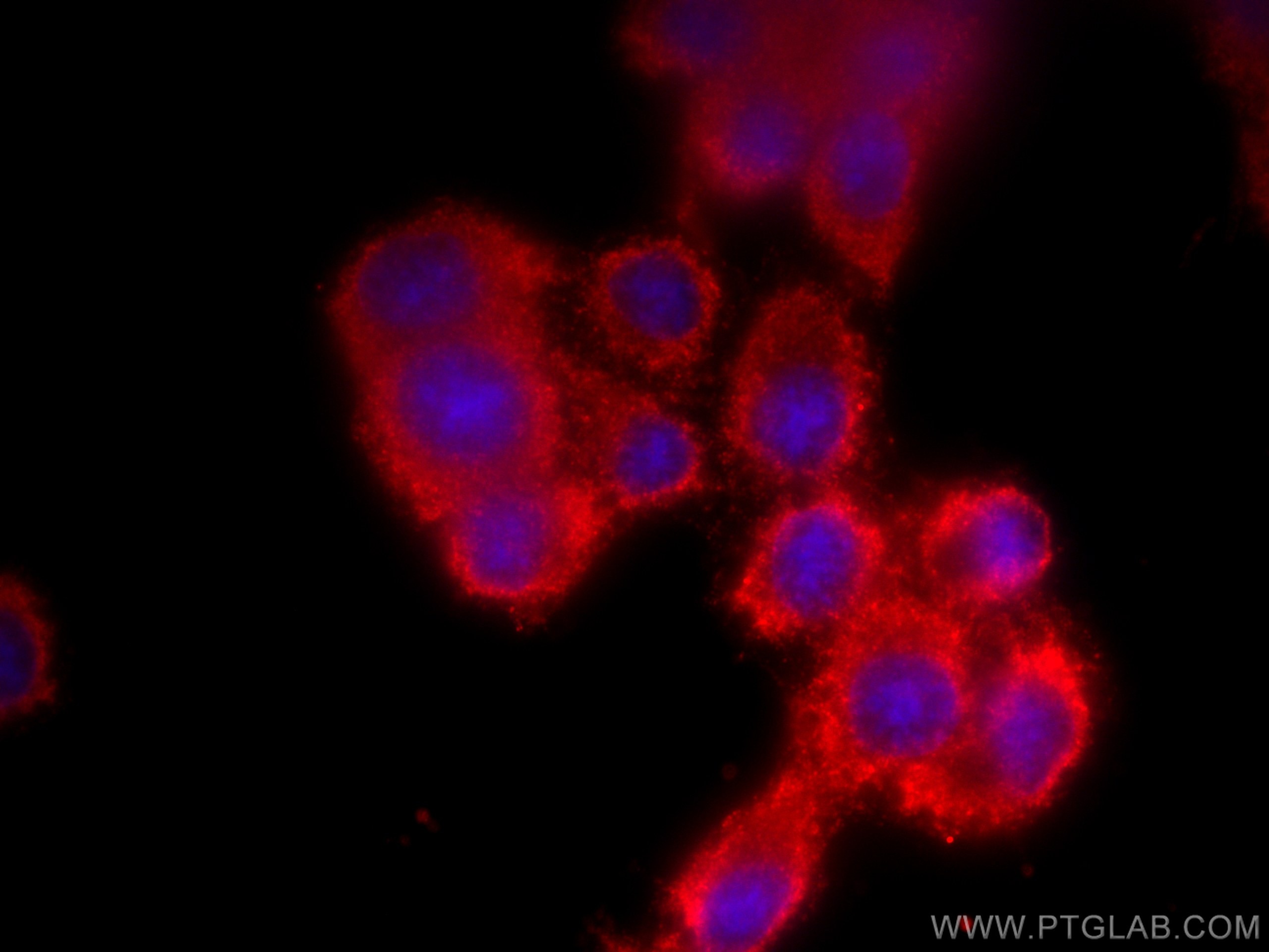 Immunofluorescence (IF) / fluorescent staining of PC-12 cells using CYP21A2 Monoclonal antibody (67421-1-Ig)