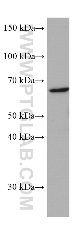 Western Blot (WB) analysis of PC-12 cells using CYP21A2 Monoclonal antibody (67421-1-Ig)