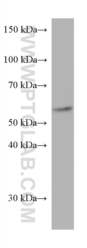 Western Blot (WB) analysis of pig adrenal gland tissue using CYP21A2 Monoclonal antibody (67421-1-Ig)