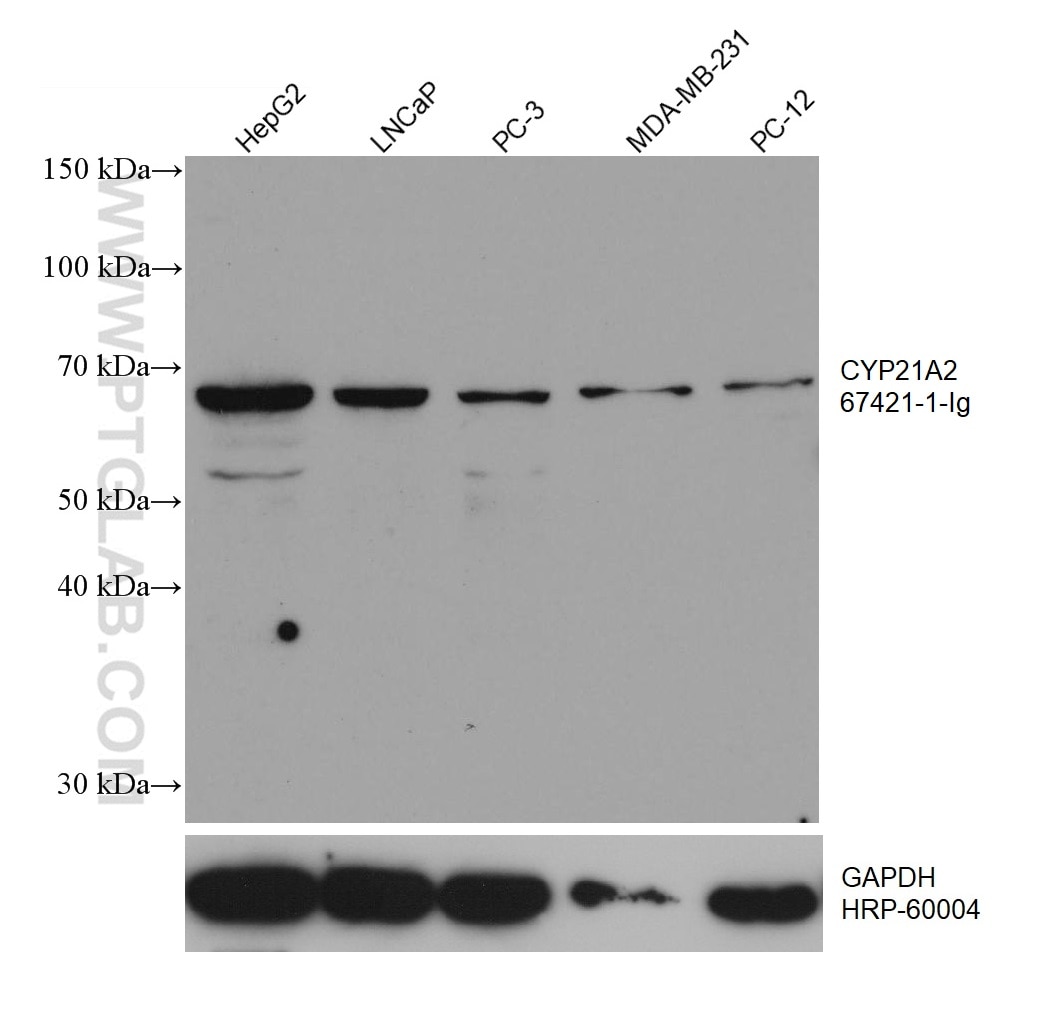Western Blot (WB) analysis of various lysates using CYP21A2 Monoclonal antibody (67421-1-Ig)