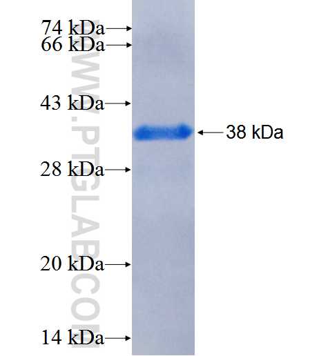 CYP21A2 fusion protein Ag26276 SDS-PAGE
