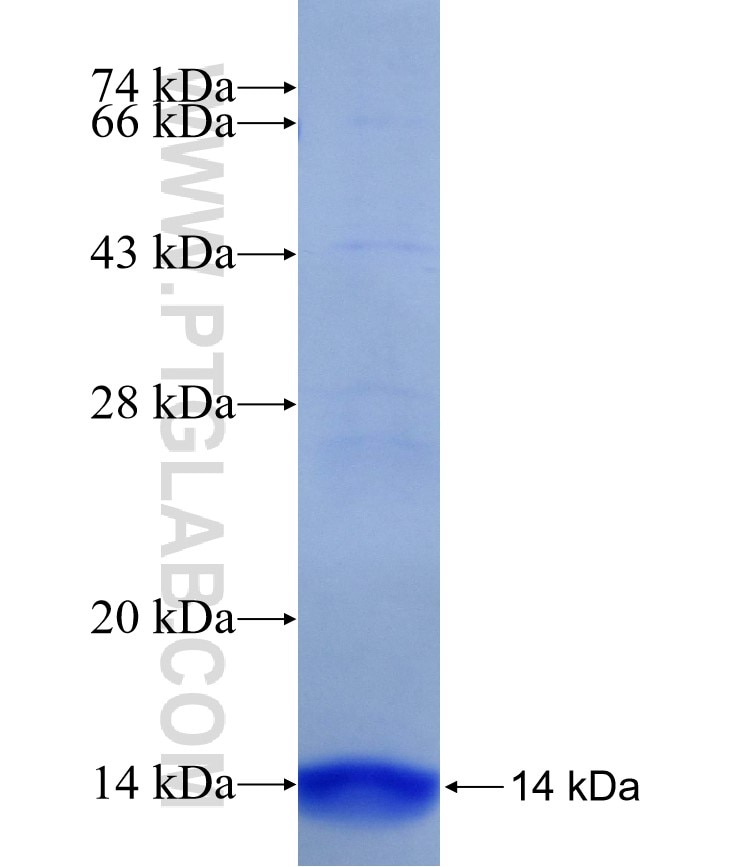 CYP21A2 fusion protein Ag26292 SDS-PAGE