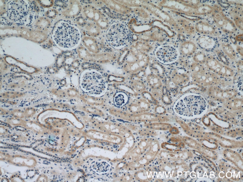 Immunohistochemistry (IHC) staining of human kidney tissue using CYP24A1 Polyclonal antibody (21582-1-AP)