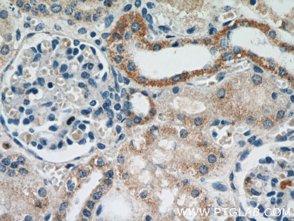 Immunohistochemistry (IHC) staining of human kidney tissue using CYP24A1 Polyclonal antibody (21582-1-AP)
