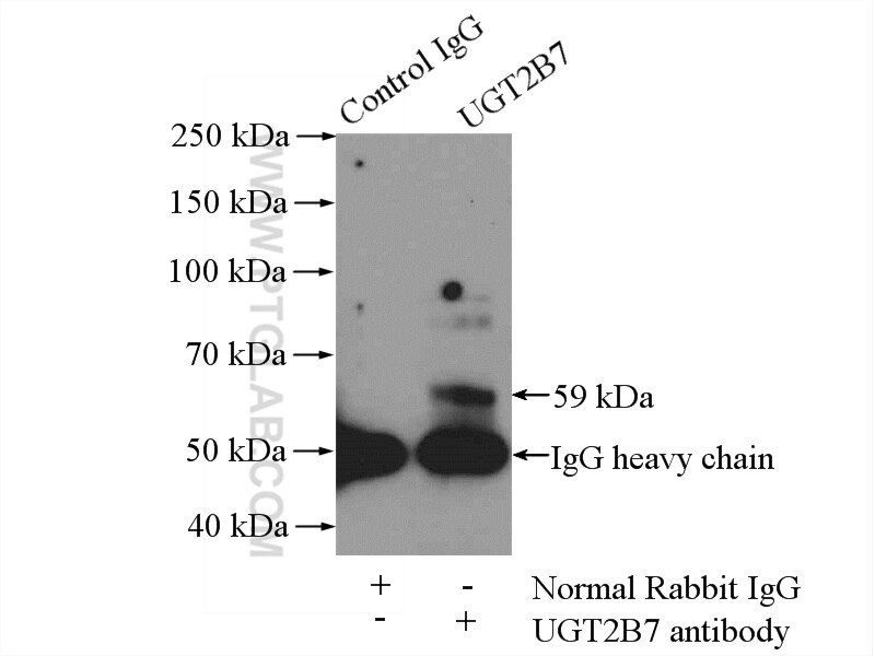 Immunoprecipitation (IP) experiment of HeLa cells using CYP24A1 Polyclonal antibody (21582-1-AP)