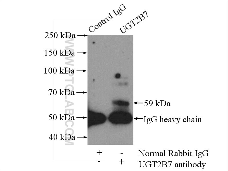 IP experiment of HeLa using 21582-1-AP