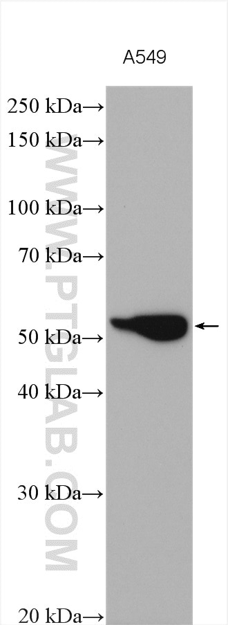 Western Blot (WB) analysis of various lysates using CYP24A1 Polyclonal antibody (21582-1-AP)