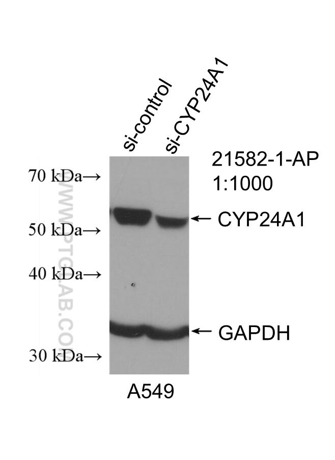 Western Blot (WB) analysis of A549 cells using CYP24A1 Polyclonal antibody (21582-1-AP)