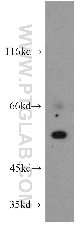 Western Blot (WB) analysis of HeLa cells using CYP24A1 Polyclonal antibody (21582-1-AP)