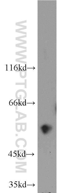 Western Blot (WB) analysis of A549 cells using CYP24A1 Polyclonal antibody (21582-1-AP)