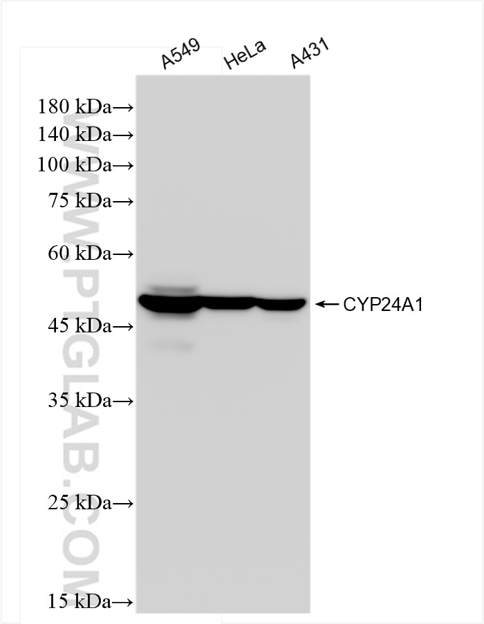 Western Blot (WB) analysis of various lysates using CYP24A1 Recombinant antibody (84821-3-RR)