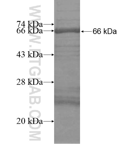 CYP24A1 fusion protein Ag16134 SDS-PAGE