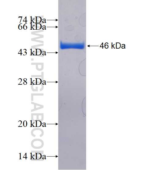 CYP24A1 fusion protein Ag17089 SDS-PAGE