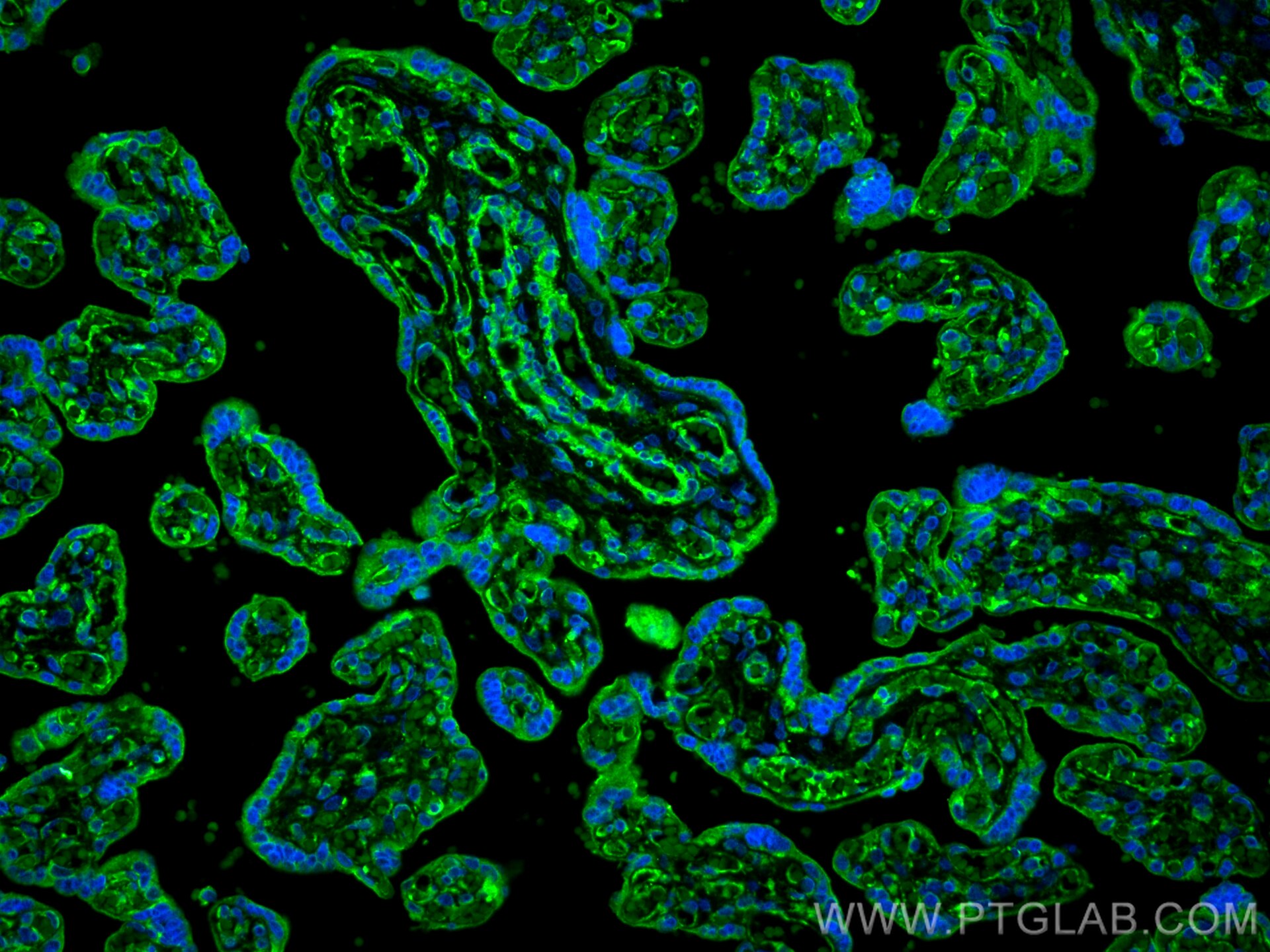 Immunofluorescence (IF) / fluorescent staining of human placenta tissue using CYP26A1 Polyclonal antibody (28081-1-AP)