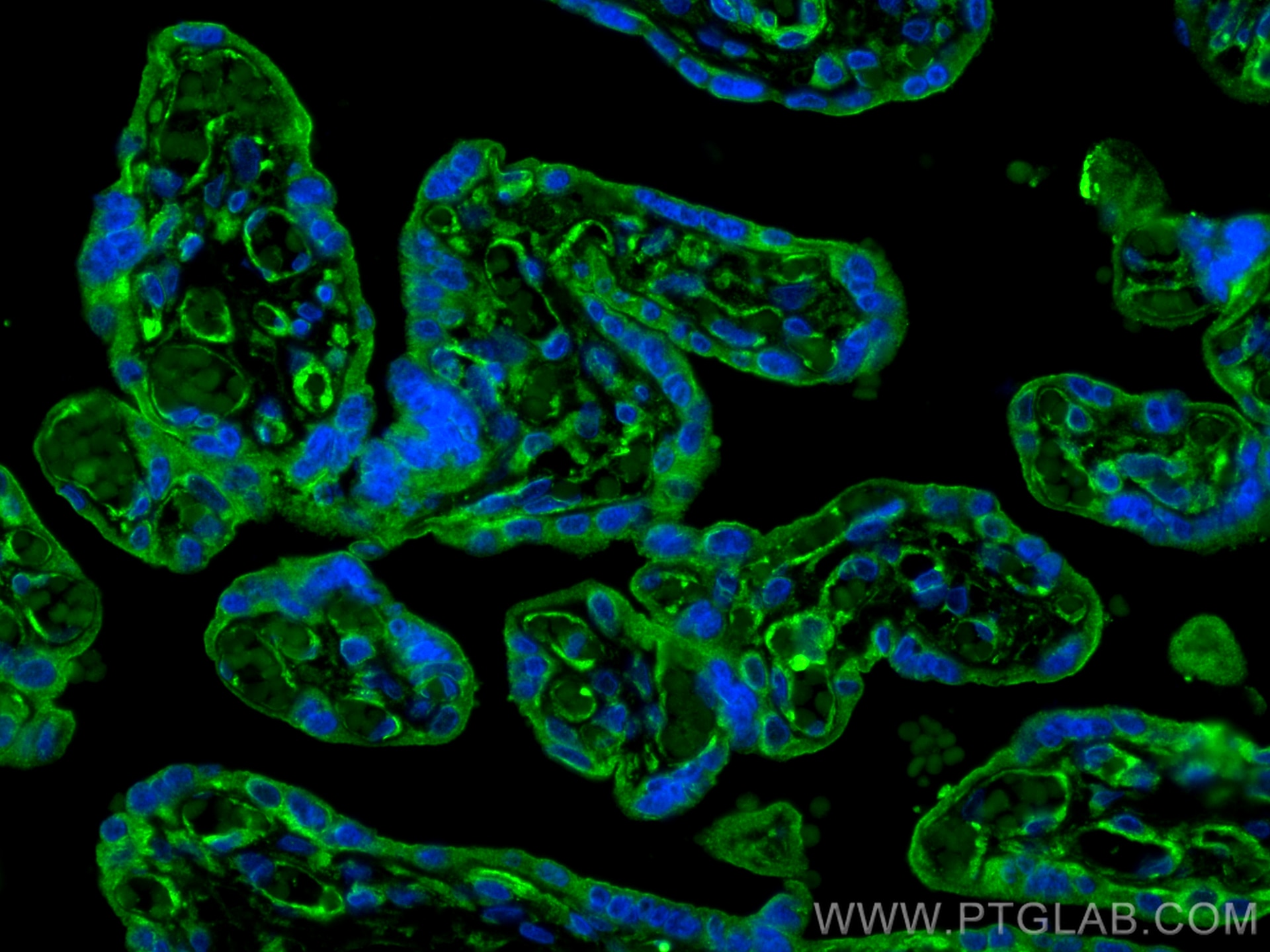 Immunofluorescence (IF) / fluorescent staining of human placenta tissue using CYP26A1 Polyclonal antibody (28081-1-AP)