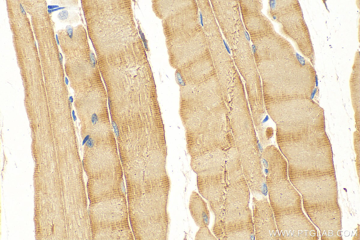 Immunohistochemistry (IHC) staining of mouse skeletal muscle tissue using CYP26A1 Polyclonal antibody (28081-1-AP)