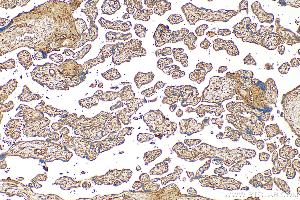 Immunohistochemistry (IHC) staining of human placenta tissue using CYP26A1 Polyclonal antibody (28081-1-AP)