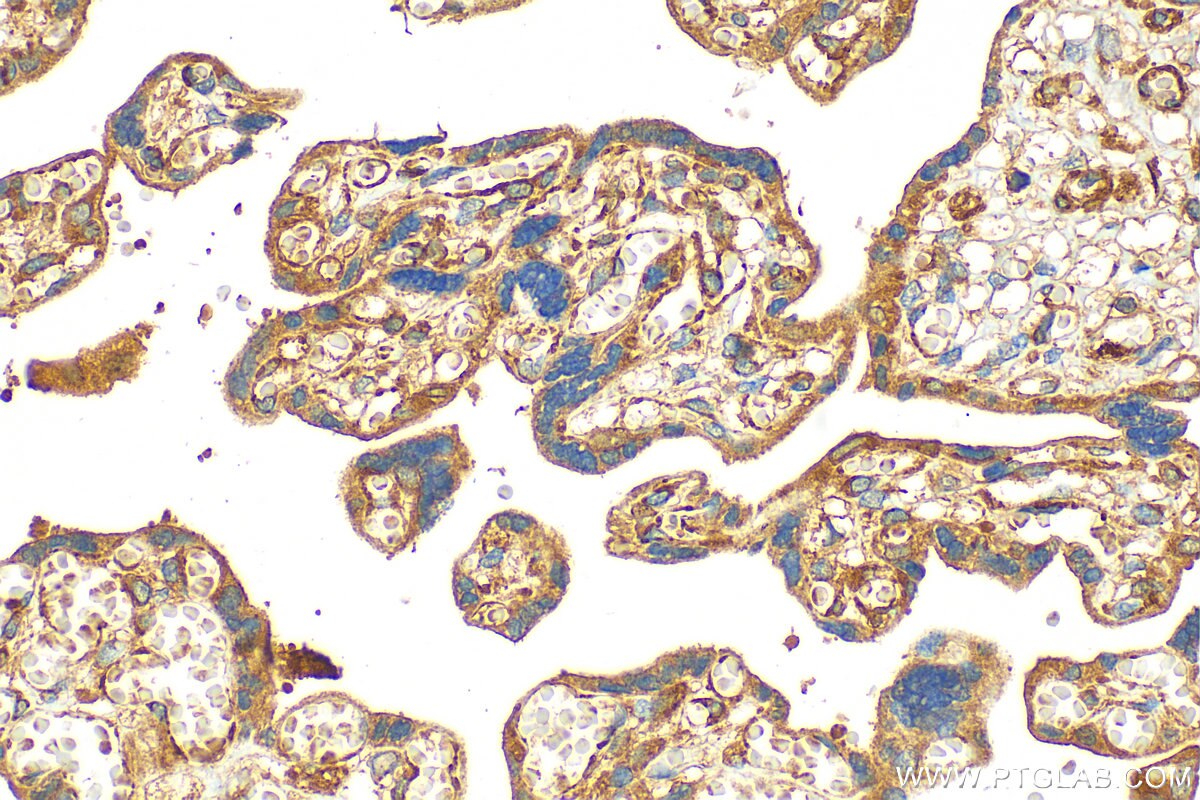 Immunohistochemistry (IHC) staining of human placenta tissue using CYP26A1 Polyclonal antibody (28081-1-AP)
