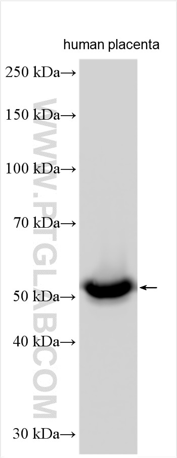 Western Blot (WB) analysis of various lysates using CYP26A1 Polyclonal antibody (28081-1-AP)