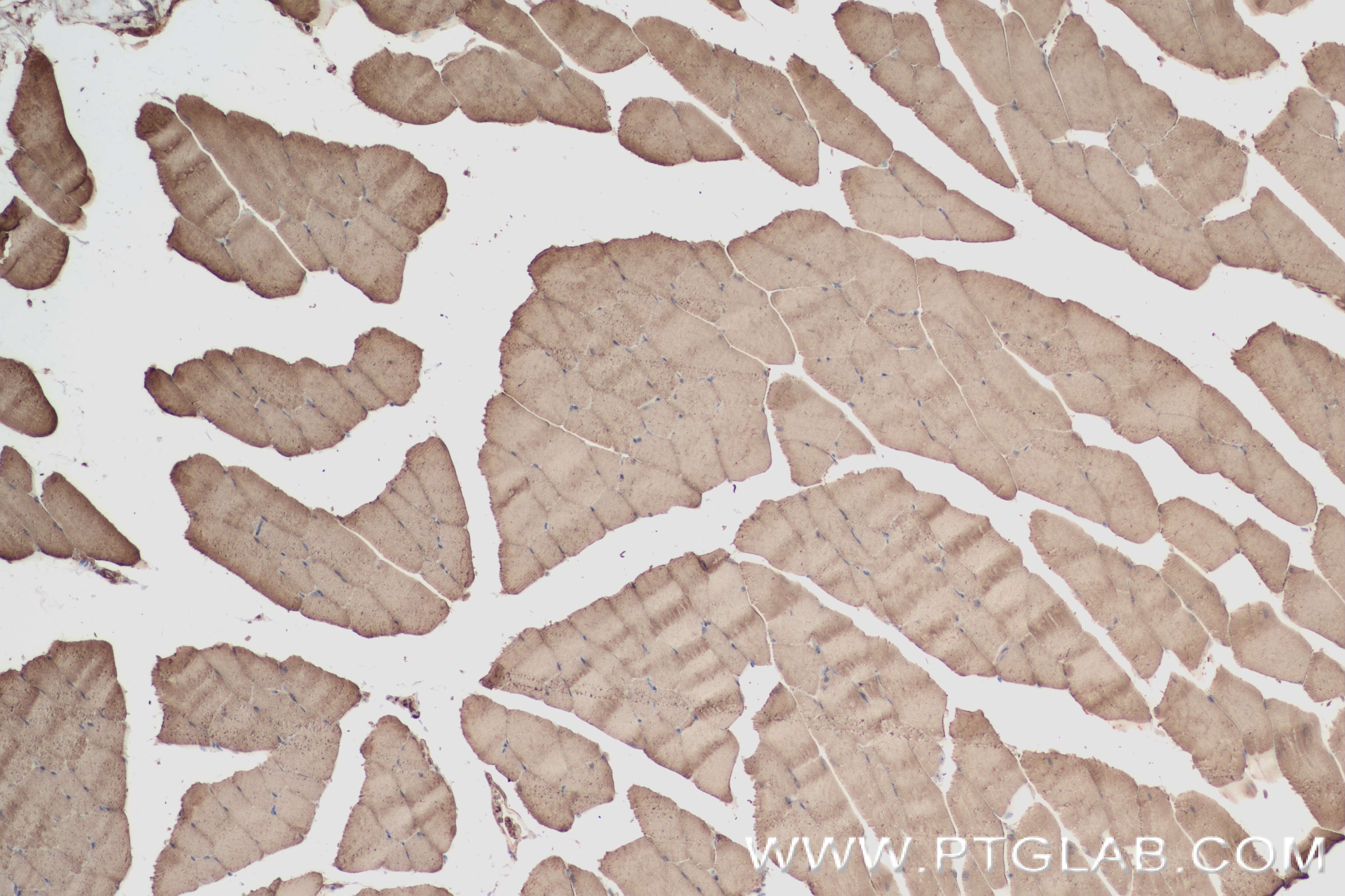 Immunohistochemistry (IHC) staining of mouse skeletal muscle tissue using CYP26A1 Recombinant antibody (84699-1-RR)