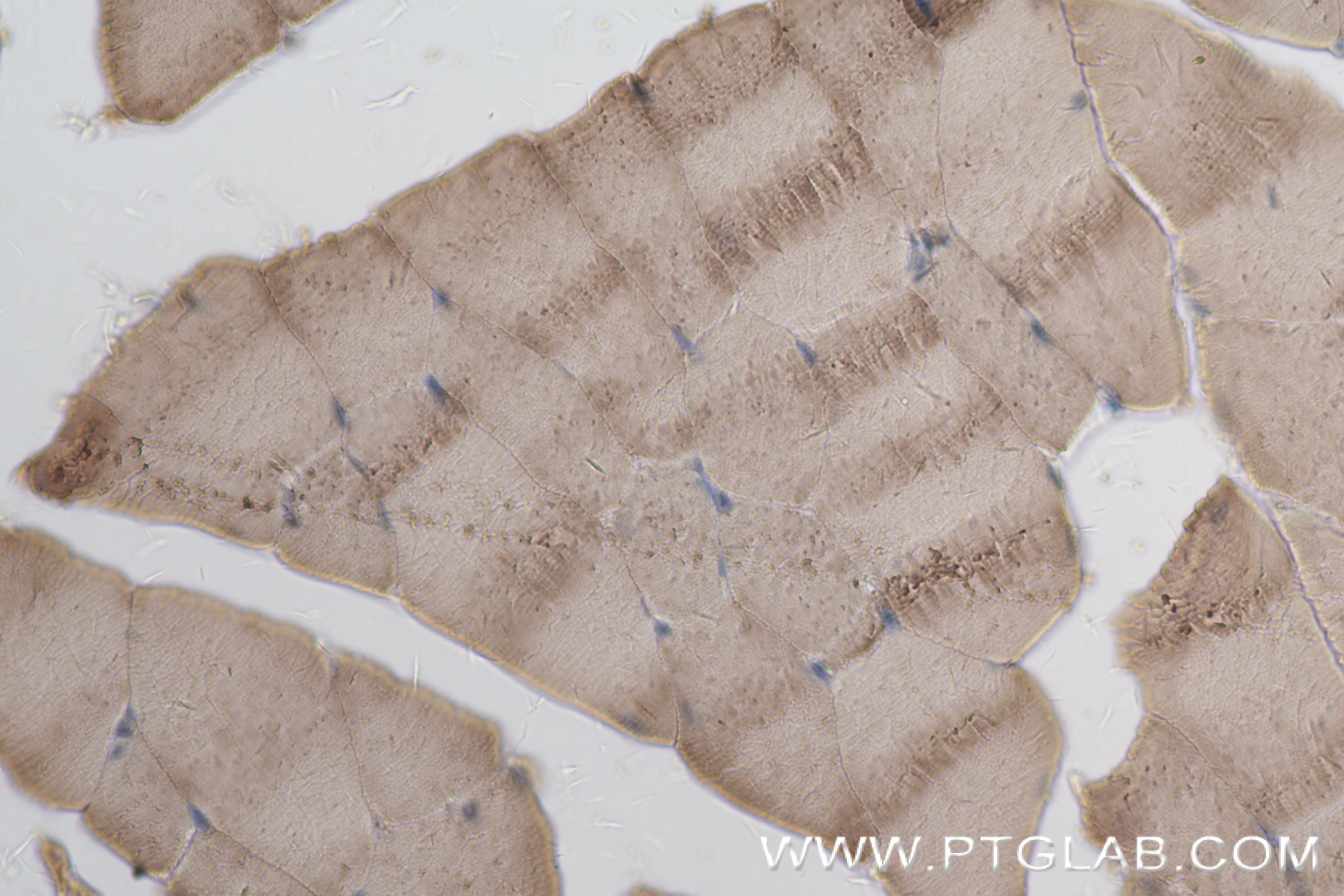 Immunohistochemistry (IHC) staining of mouse skeletal muscle tissue using CYP26A1 Recombinant antibody (84699-1-RR)