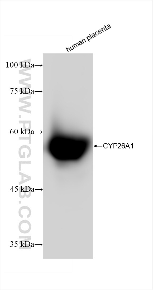 Western Blot (WB) analysis of various lysates using CYP26A1 Recombinant antibody (84699-1-RR)